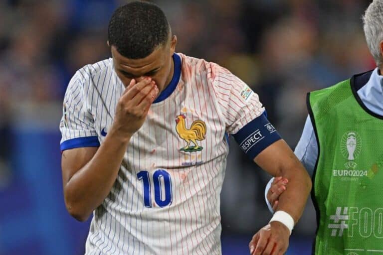 A broken nose for Mbappé and a bloodied forehead for Griezmann: France gave their all for victory over Austria