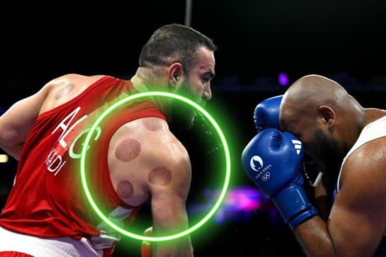 What are those red spots on the athletes’ bodies at the Olympics?